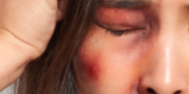 Accusation: attacked and threatened his partner on several occasions and even sprayed her with tear gas